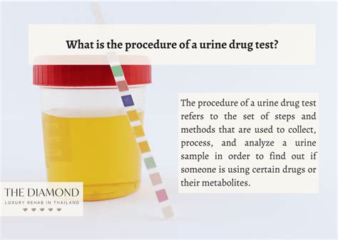 can clear eye eye drops alter a urine drug test|urinary drug of abuse test.